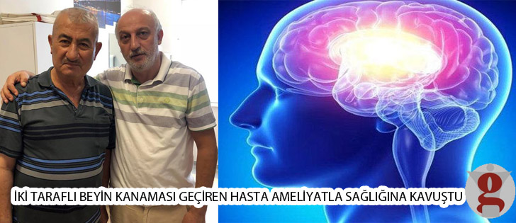 İki Taraflı Beyin Kanaması Geçiren Hasta Ameliyatla Sağlığına Kavuştu