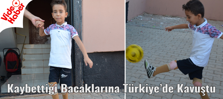  Kaybettiği Bacaklarına Türkiyede Kavuştu
