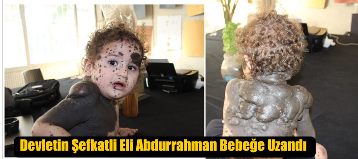 Devletin Şefkatli Eli Abdurrahman Bebeğe Uzandı