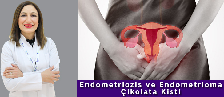 Endometriozis ve Endometrioma çikolata kisti Sağlık HATAY