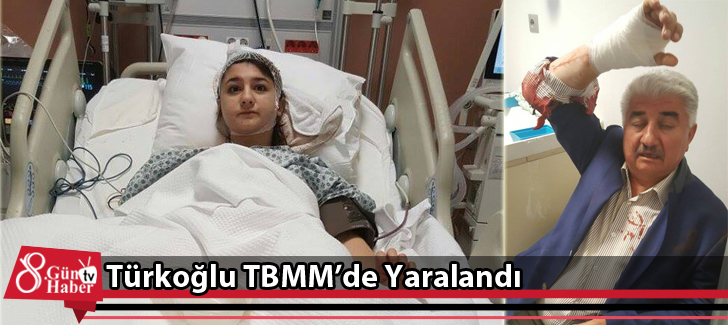 Türkoğlu TBMMde Yaralandı
