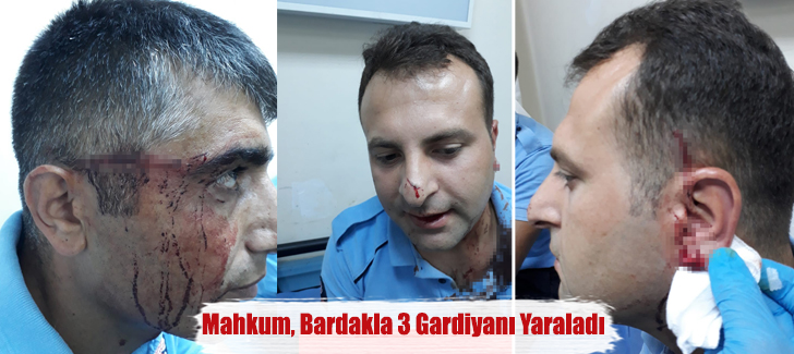 Osmaniye cezaevinde mahkum, bardakla 3 gardiyanı yaraladı
